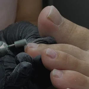 Gel removal(pedicure)